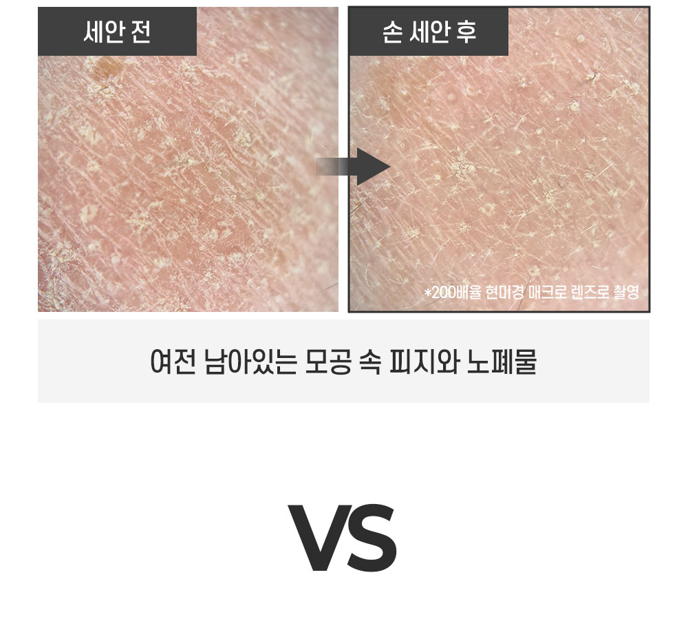 상세