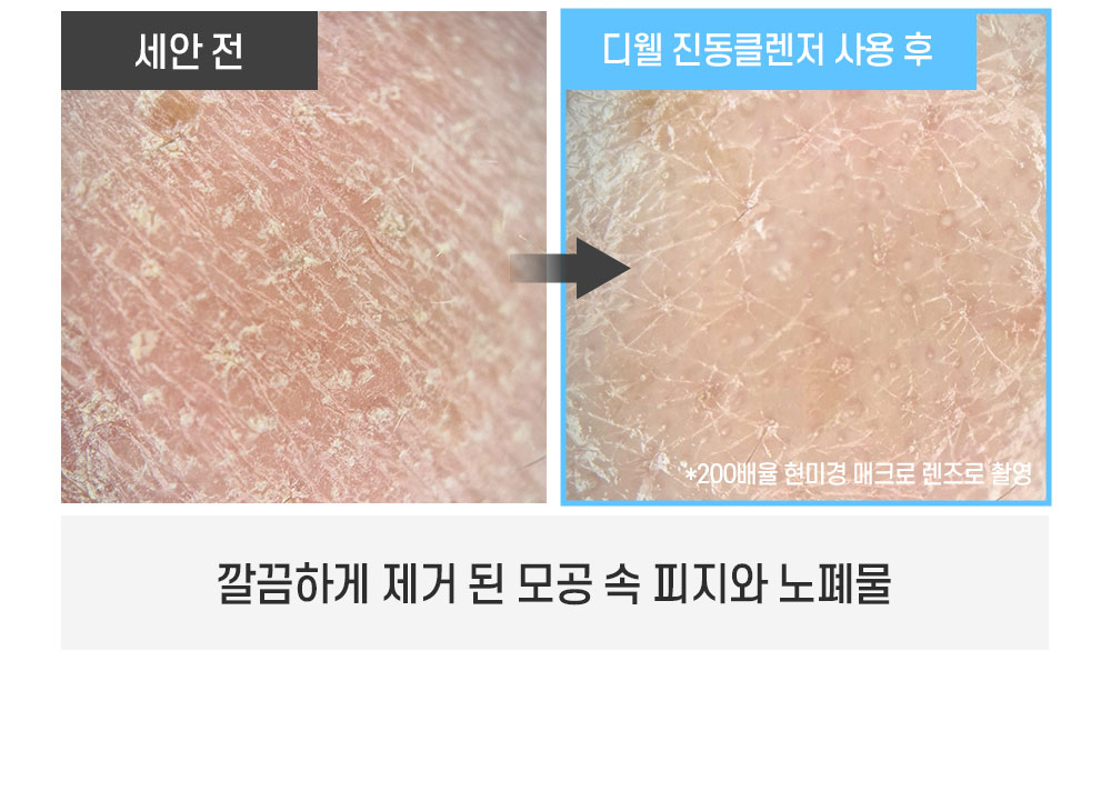 상세